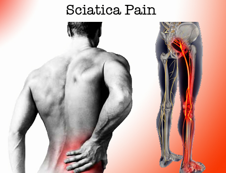 Are you suffering with sciatica?